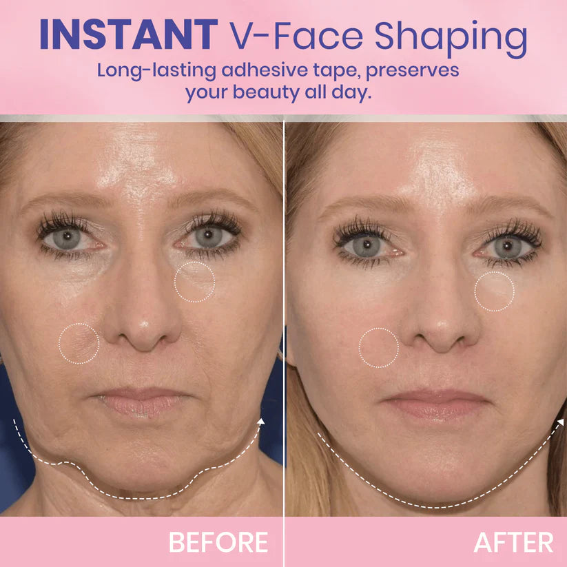 Faugettt™ V-Face Lifting Adhesive Tape