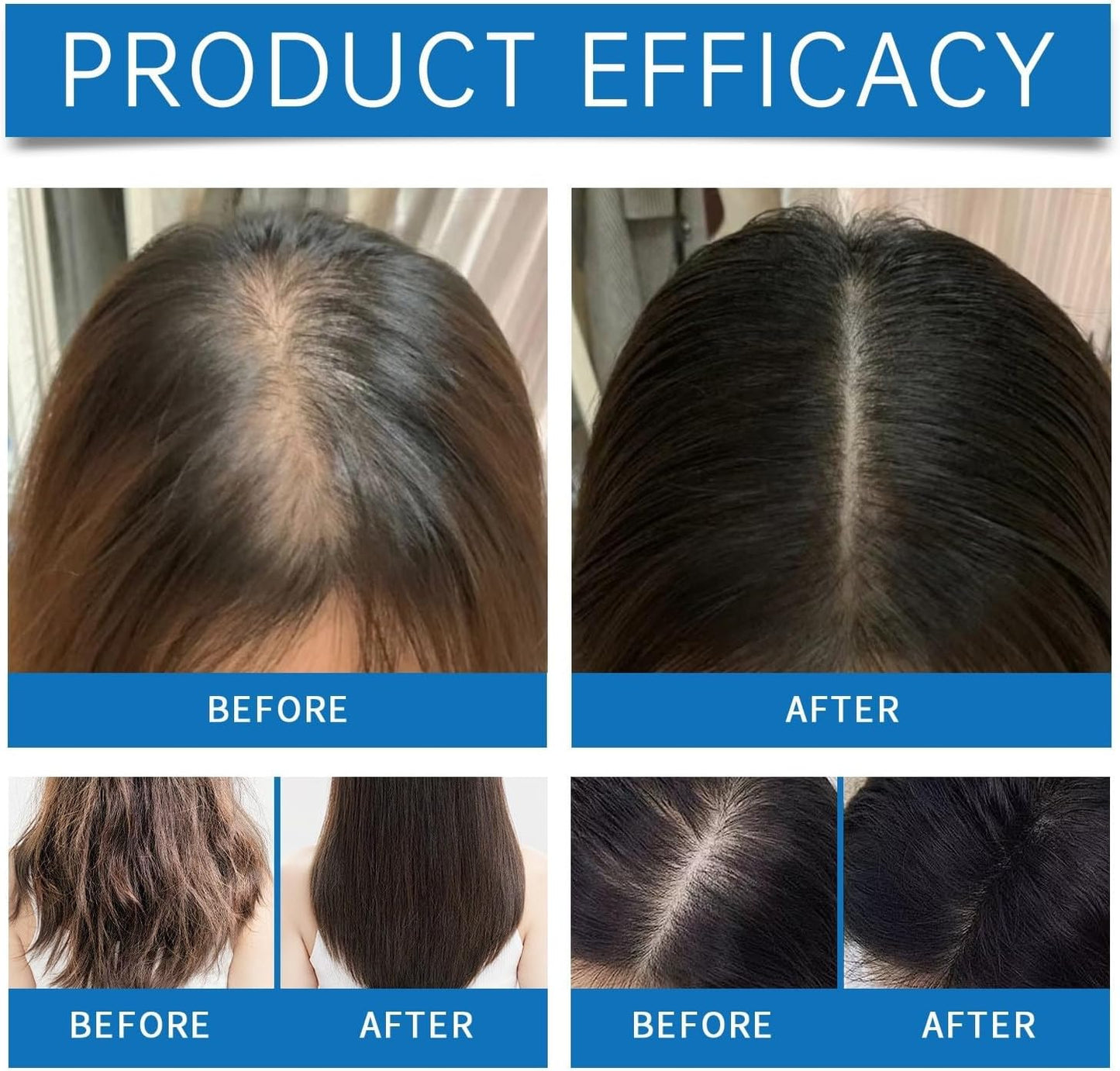 Scalpy Hair Growth Serum –  Salicylic Acid & Menthol