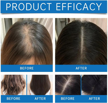 Scalpy Hair Growth Serum –  Salicylic Acid & Menthol