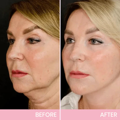 Faugettt™ V-Face Lifting Adhesive Tape